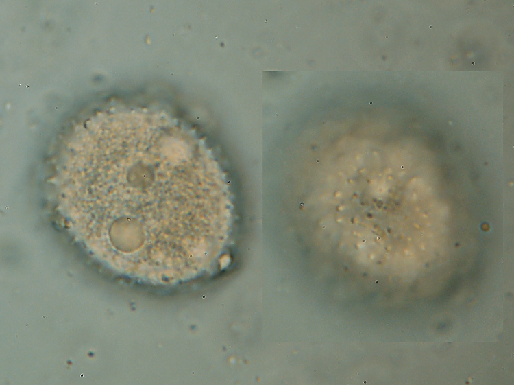 Aleurodiscus amorphus (Fr.)Schroeter